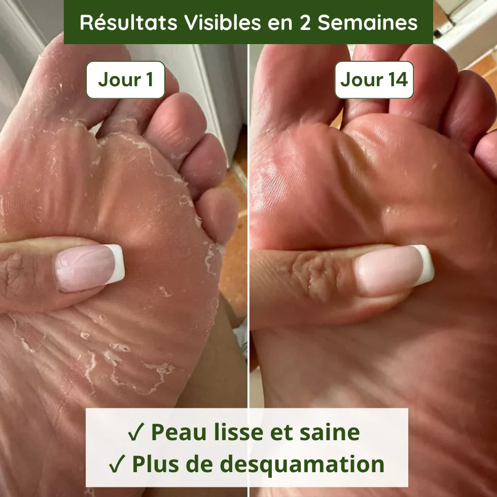 Savon Anti-Mycoses Verdalyae