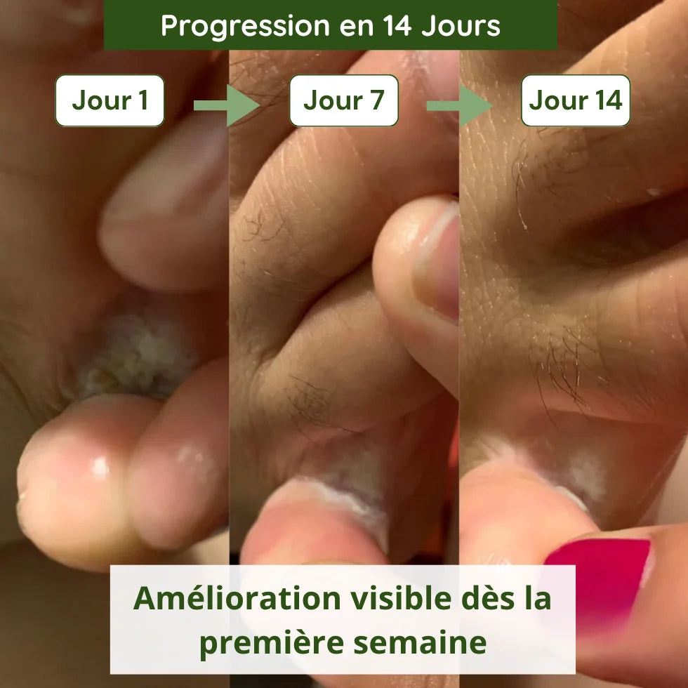 Savon Anti-Mycoses Verdalyae